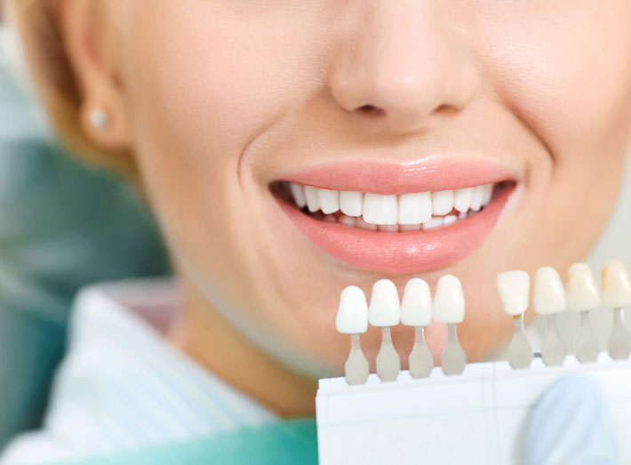 Cosmetic dental services
