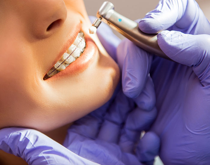 Dentist performing braces treatment