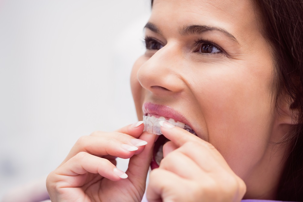 woman wearing invisalign