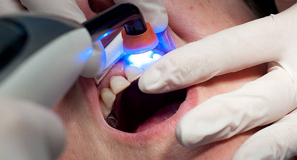 Restorative Dental Services