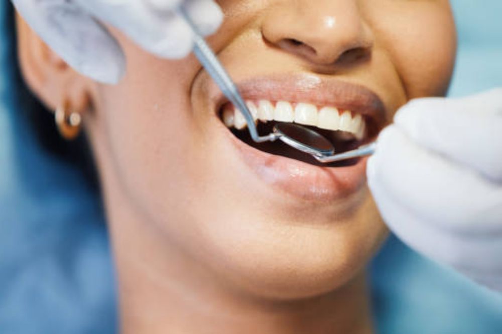 teeth whitening